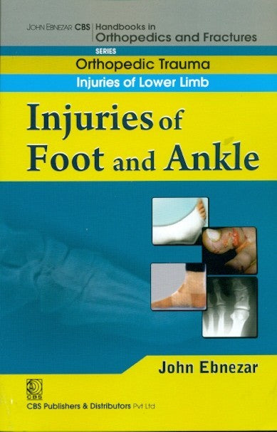 Injuries Of Foot And Ankle (Handbook In Orthopedics And Fractures Series Vol 18 Orthopedic Trauma Injuries Of Lower Limb (2012), by John Ebnezar