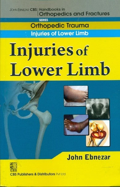 Injuries Of Lower Limb (Handbook In Orthopedics And Fractures Vol 19 Orthopedic Trauma Injuries Of Lower Limb (2012), by John Ebnezar