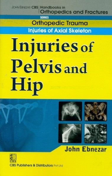 Injuries Of Pelvis And Hip (Handbook In Orthopedics And Fractures Vol 20 Orthopedic Trauma Injuries Of Axial Skeleton (2012), by John Ebnezar