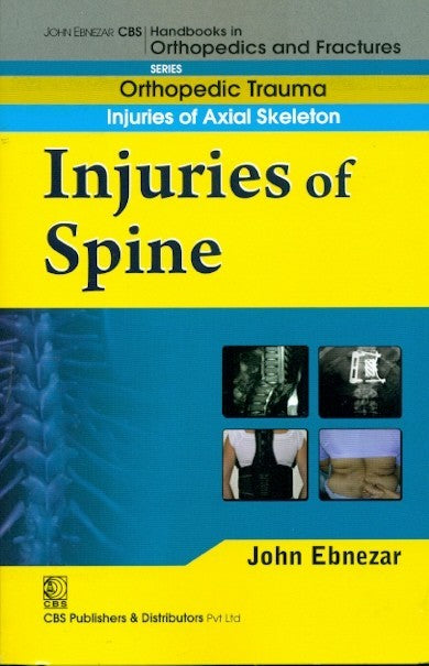 Injuries Of Spine (Handbook Of Orthopedics And Fractures Series Vol 21 Orthopedic Trauma Injuries Of Axial Skeleton (2012), by John Ebnezar
