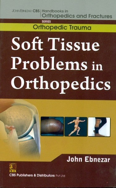 Soft Tissue Problems In Orthopedics (Handbooks In Orthopedics And Fractures Series Vol 25 Orthopedic Trauma (2012), by John Ebnezar