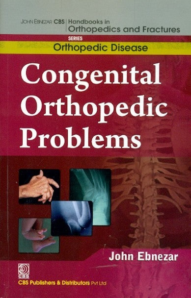 Congenital Orthopedic Problems (Handbooks In Orthopedics And Fractures Series Vol 28 Orthopedic Disease) A (2012), by John Ebnezar