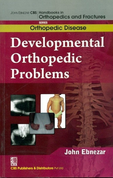 Developmental Orthopedic Problems (Handbooks In Orthopedics And Fractures Series Vol 29 Orthopedic Disease (2012), by John Ebnezar
