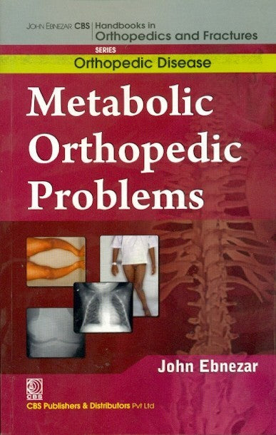 Metabolic Orthopedic Problems (Handbooks In Orthopedics And Fractures Series Vol 30 Orthopedic Disease) (2012), by John Ebnezar