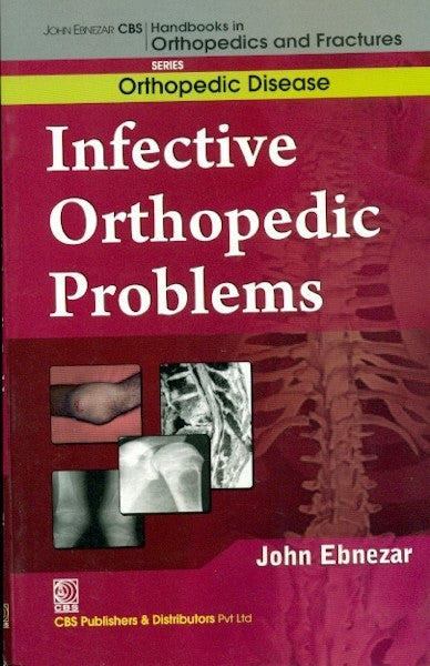 Infective Orthopedic Problems Developmental Orthopedic Problems (Handbooks In Orthopedics And Fractures Series Vol 31 Orthopedic Disease) (Pb 2012), by John Ebnezar