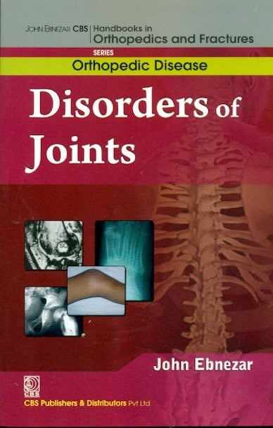 Disorders Of Joints (Handbooks In Orthopedics And Fractures Series Vol 32 Orthopedic Disease (2012), by John Ebnezar