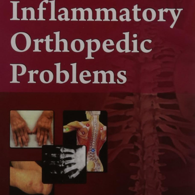 Inflammatory Orthopedic Problems (Handbooks In Orthopedics And Fractures Series Vol 34 Orthopedic Disease (2012), by John Ebnezar