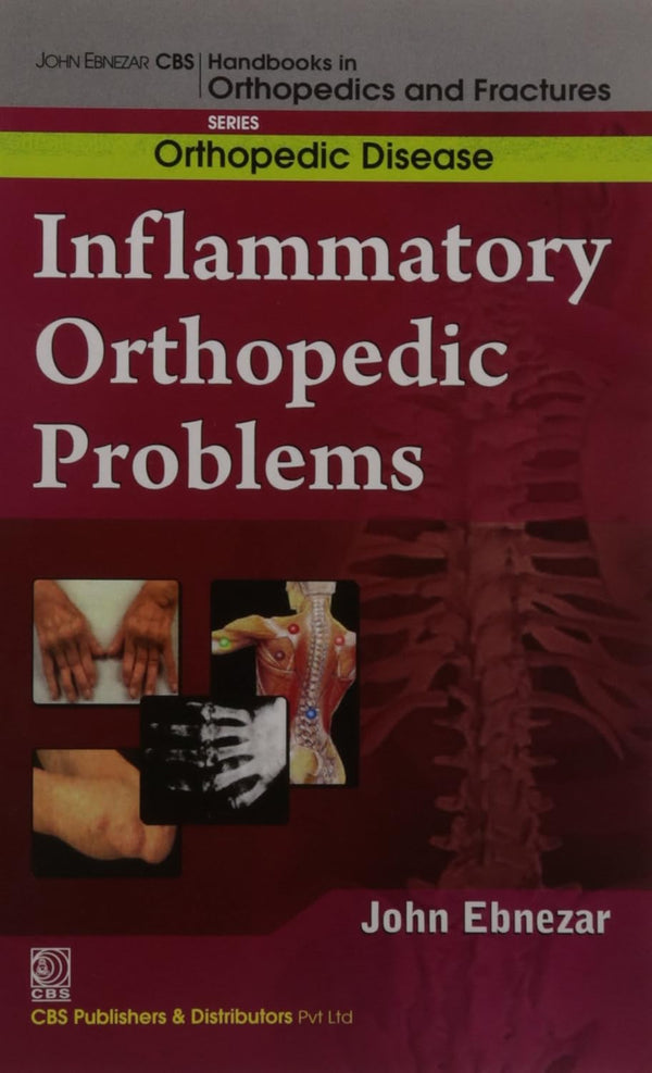 Inflammatory Orthopedic Problems (Handbooks In Orthopedics And Fractures Series Vol 34 Orthopedic Disease (2012), by John Ebnezar