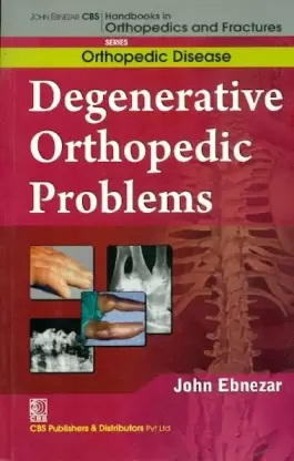 Degenerative Orthopedic Problems (Handbooks In Orthopedics And Fractures Series Vol35 Orthopedic Disease)Ma (2012), by John Ebnezar