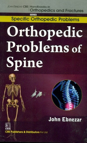 Orthopedic Problems Of Spine (Handbooks In Orthopedics And Fractures Series Vol 38 Specific Orthopedic Problems (2012), by John Ebnezar