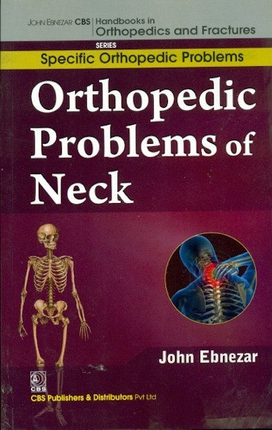 Orthopedic Problems Of Neck (Handbooks In Orthopedics And Fractures Series Vol 39 Specific Orthopedic Problems (2012), by John Ebnezar