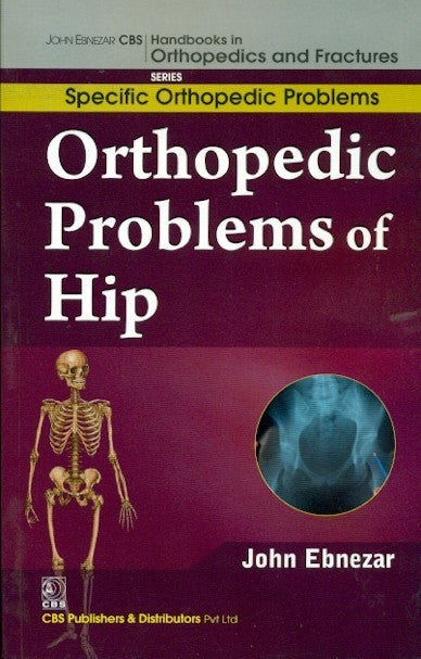 Orthopedic Problems Of Hip (Handbooks In Orthopedics And Fractures Series Vol 40 Specific Orthopedic Problems (2012), by John Ebnezar