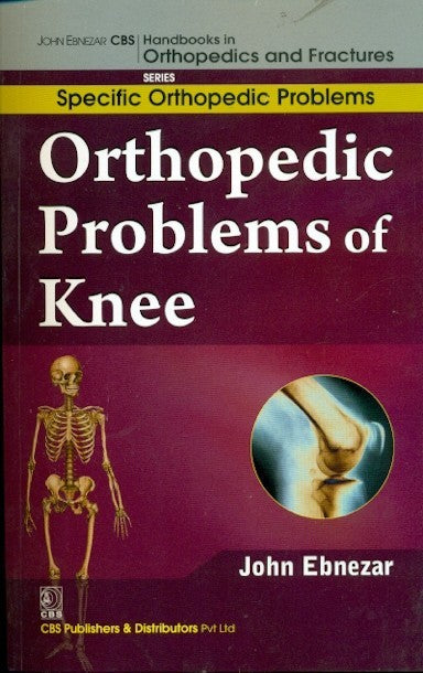 Orthopedic Problems Of Knee (Handbooks In Orthopedics And Fractures Series Vol 41 Specific Orthopedic Problems (2012), by John Ebnezar