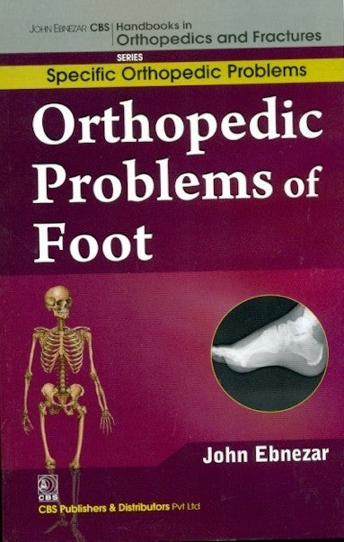 Orthopedic Problems Of Foot (Handbooks In Orthopedics And Fractures Series Vol 42 Specific Orthopedic Problems (2012), by John Ebnezar