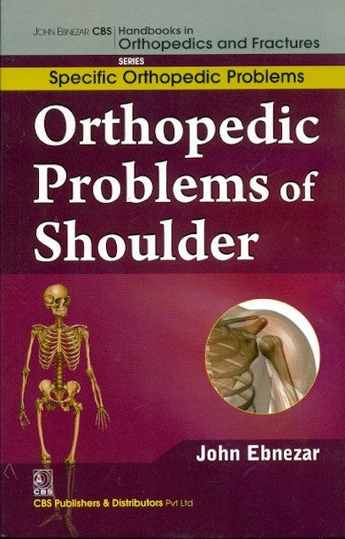 Orthopedic Problems Of Shoulder (Handbooks In Orthopedics And Fractures Series Vol 43 Specific Orthpedic Problems (2012), by John Ebnezar