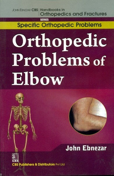 Orthopedic Problems Of Elbow (Handbooks In Orthopedics And Fractures Series Vol 44 Specific Orthopedic Problems (2012), by John Ebnezar