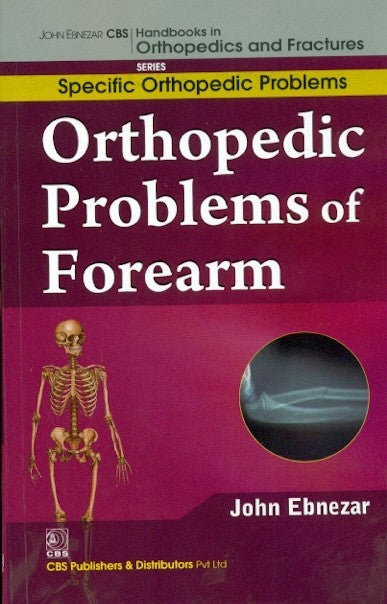 Orthopedic Problems Of Forearm (Handbooks In Orthopedics And Fractures Series Vol 45 Specific Orthopedic Problems (2012), by John Ebnezar