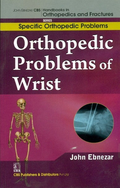 Orthopedic Problems Of Wrist (Handbooks In Orthopedics And Fractures Series Vol 46 Specific Orthopedic Problems (2012), by John Ebnezar