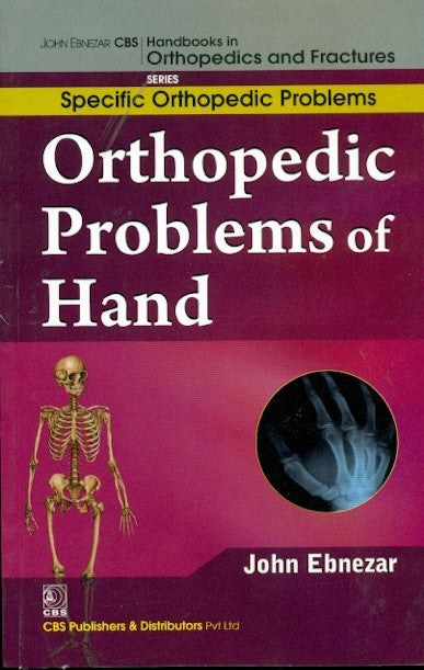 Orthopedic Problems Of Hand (Handbooks In Orthopedics And Fractures Series Vol 47 Specific Orthopedic Problems (2012), by John Ebnezar