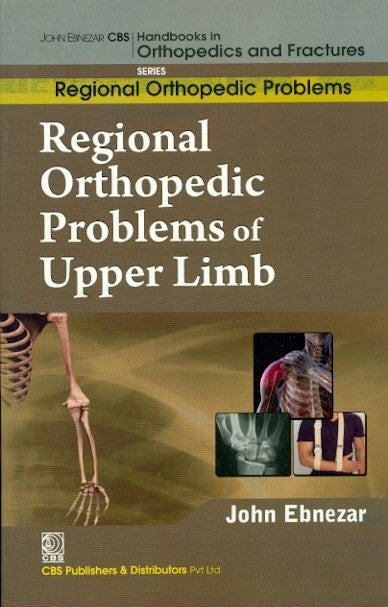 Regional Orthopedic Problems Of Upper Limb (Handbooks In Orthopedics And Fractures Series Vol 48 Regional Orthopedic Problems (2012), by John Ebnezar