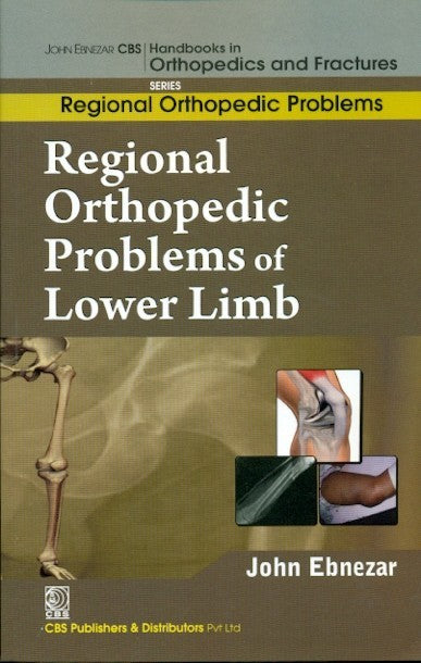 Regional Orthopedic Problems Of Lower Limb (Handbooks In Orthopedics And Fractures Series Vol 49 Regional Orthopedic Problems (2012), by John Ebnezar