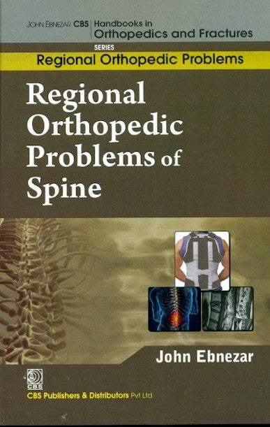 Regional Orthopedic Problems Of Spine (Handbooks In Orthopedics And Fractures Series Vol 50 Regional Orthopedic Problems (2012), by John Ebnezar