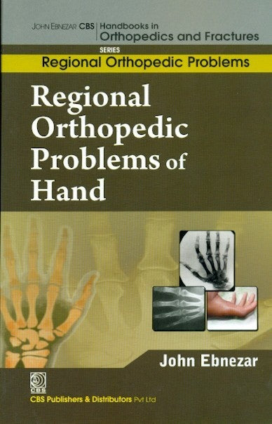 Regional Orthopedic Problems Of Hand (Handbooks In Orthopedics And Fractures Series Vol 51 Regional Orthopedic Problems (2012), by John Ebnezar