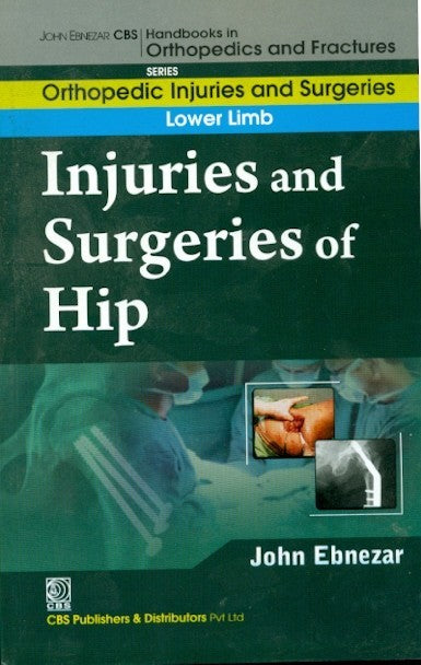 Injuries And Surgeries Of Hip (Handbooks In Orthopedics And Fractures Series Vol 55 Orthopedic Injuries And Surgeries Lower Limb (2012), by John Ebnezar