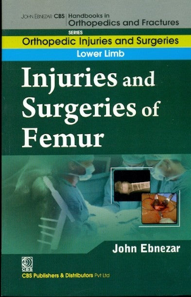 Injuries And Surgeries Of Femur (Handbooks In Orthopedics And Fractures Series Vol 56 Lower Limb (2012), by John Ebnezar