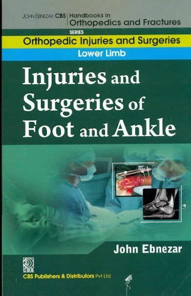 Injuries And Surgeries Of Foot And Ankle (Handbooks In Orthopedics And Fractures Series Vol 58 Orthopedic Injuries And Surgeries Lower Limb (2012), by John Ebnezar