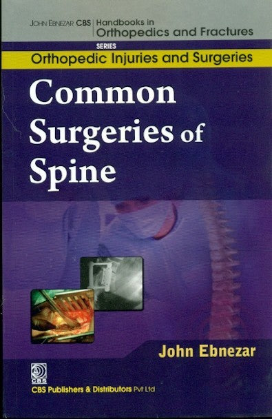 Common Surgeries Of Spine (Handbooks In Orthopedics And Fractures Series Vol 59 Orthopedic Injuries And Surgeries (2012), by John Ebnezar