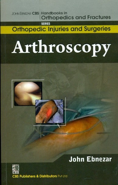 Arthroscopy (Handbooks In Orthopedics And Fractures Series Vol 61 Orthopedic Injuries And Surgeries (2012), by John Ebnezar