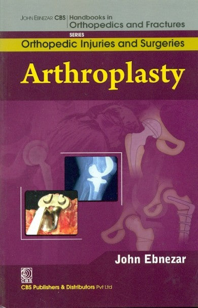 Arthroplasty (Handbooks In Orthopedics And Fractures Series Vol 62 Orthopedic Injuries And Surgeries (2012), by John Ebnezar