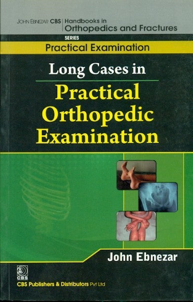 Long Cases In Practicalorthopedic Examination (Handbooks In Orthopedics And Fractures Series Vol 63 Practical Examination (2012), by John Ebnezar