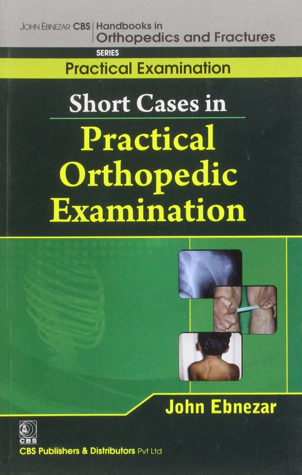 Short Cases In Practical Orthopedic Examination (Handbooks In Orthopedics And Fractures Series Vol 64 Practical Examination (2012), by John Ebnezar