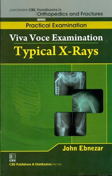 Typical X Rays (Handbooks In Orthopedics And Fractures Series Vol 65 Practical Examination (2012), by John Ebnezar