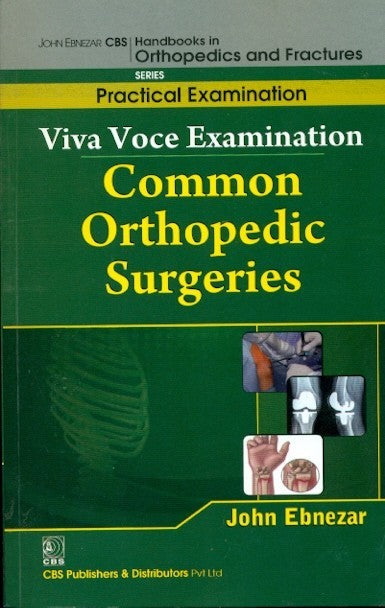 Viva Voce Examination Common Orthopedic Surgeries (Handbooks In Orthopedics And Fractures Series Vol 69 Practical Examination (2012), by John Ebnezar