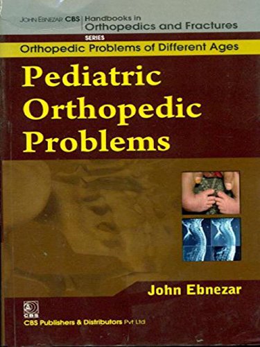 Pediatric Orthopedic Problems (Handbooks In Orthopedics And Fractures Series Vol 72 Orthopedic Problems Of Different Ages (2012), by John Ebnezar