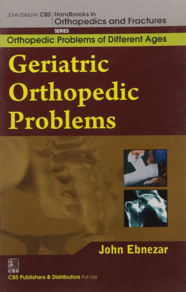 Geriatric Orthopedic Problems (Handbooks In Orthopedics And Fractures Series Vol 78 Orthopedic Problems Of Differnet Ages (2012), by John Ebnezar