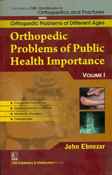 Orthopedic Problems Of Public Health Importance (Handbooks Of Orthopedics And Fractures Series 1 Vol 82 Orthopedic Problems Of Different Ages (2012), by John Ebnezar
