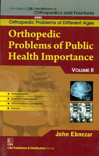 Orthopedic Problems Of Public Health Importance 11 (Handbooks In Orthopedics And Fractures Series Vol 83 Orthopedic Problems Of Different Ages (2012), by John Ebnezar