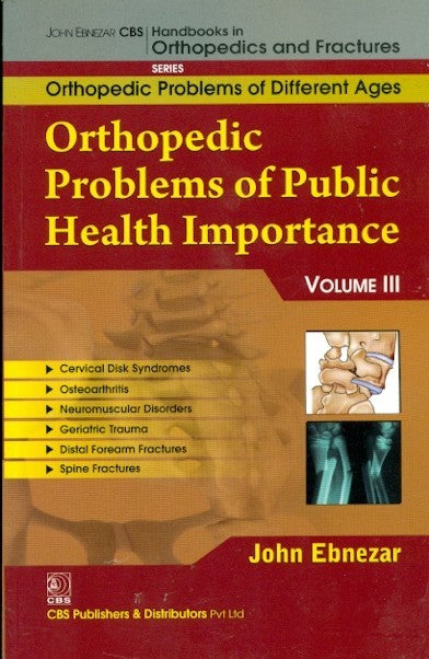 Orthopedic Problems Of Public Health Importance Vol Iii No 84 (Orthopedic Problems Of Different Ages (2012), by John Ebnezar