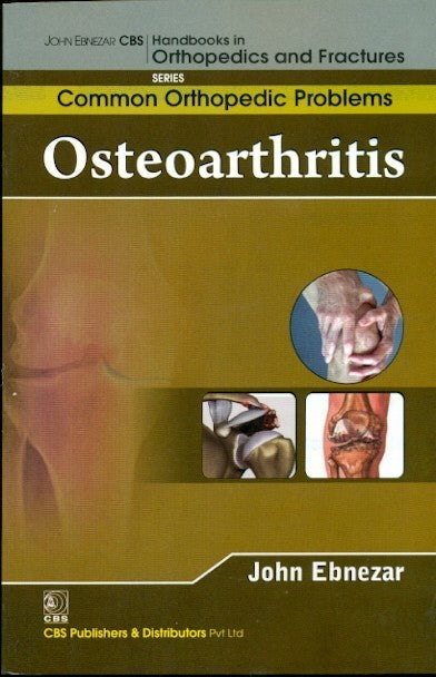 Osteoarthritis (Handbooks In Orthopedics And Fractures Series Vol 87 Common Orthopedic Problems (2012), by John Ebnezar