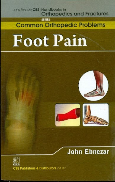 Foot Pain (Handbooks In Orthopedics And Fractures Series Vol 91 Common Orthopedic Problems (2012), by John Ebnezar