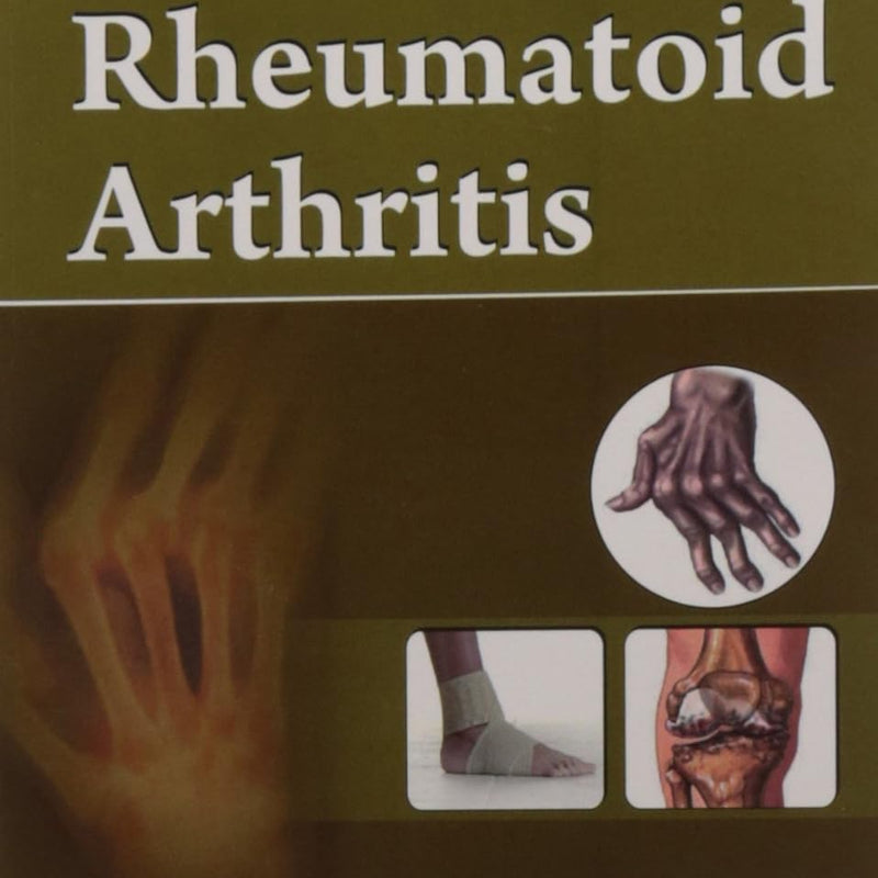 Rheumatoid Arthritis (Handbooks In Orthopedics And Fractures Series Vol 92 Common Orthopedic Problems (2012), by John Ebnezar