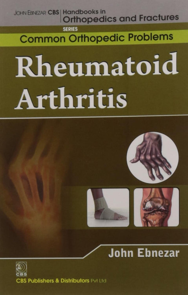 Rheumatoid Arthritis (Handbooks In Orthopedics And Fractures Series Vol 92 Common Orthopedic Problems (2012), by John Ebnezar