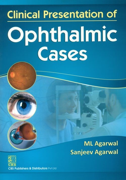 Clinical Presentation Of Opthalmic Cases (Pb2014) , by M L Agarwal