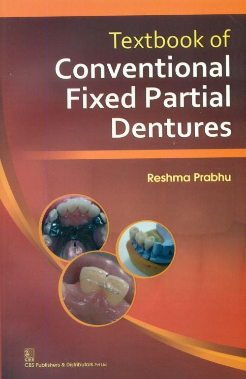 Textbook Of Conventional Fixed Partial Dentures (Pb 2014), by Reshma Prabhu