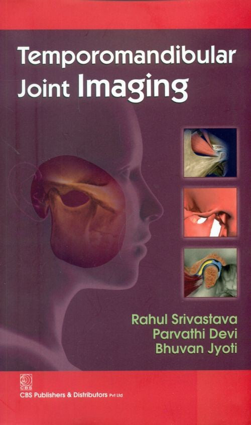 Temporomandibular Joint Imaging (Pb 2014), by Rahul Srivastava