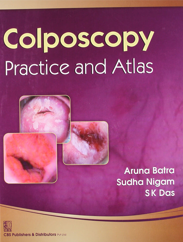 Colposcopy Practice And Atlas (Hb 2014) , by Aruna Batra